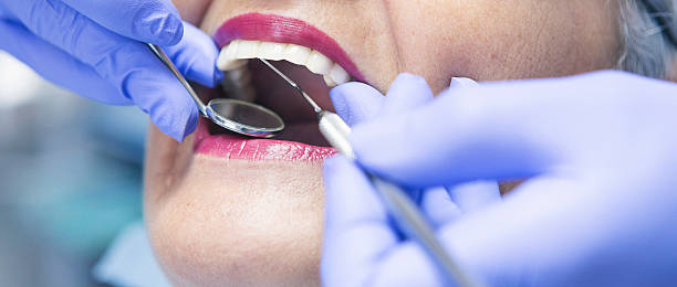 Best Emergency Dental Services for Seniors in Hodgkins, IL