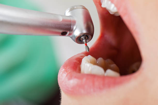 Best Emergency Dentist for Knocked-Out Tooth in Hodgkins, IL